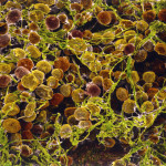 EA fat cells adipose tissue SEM 117453006